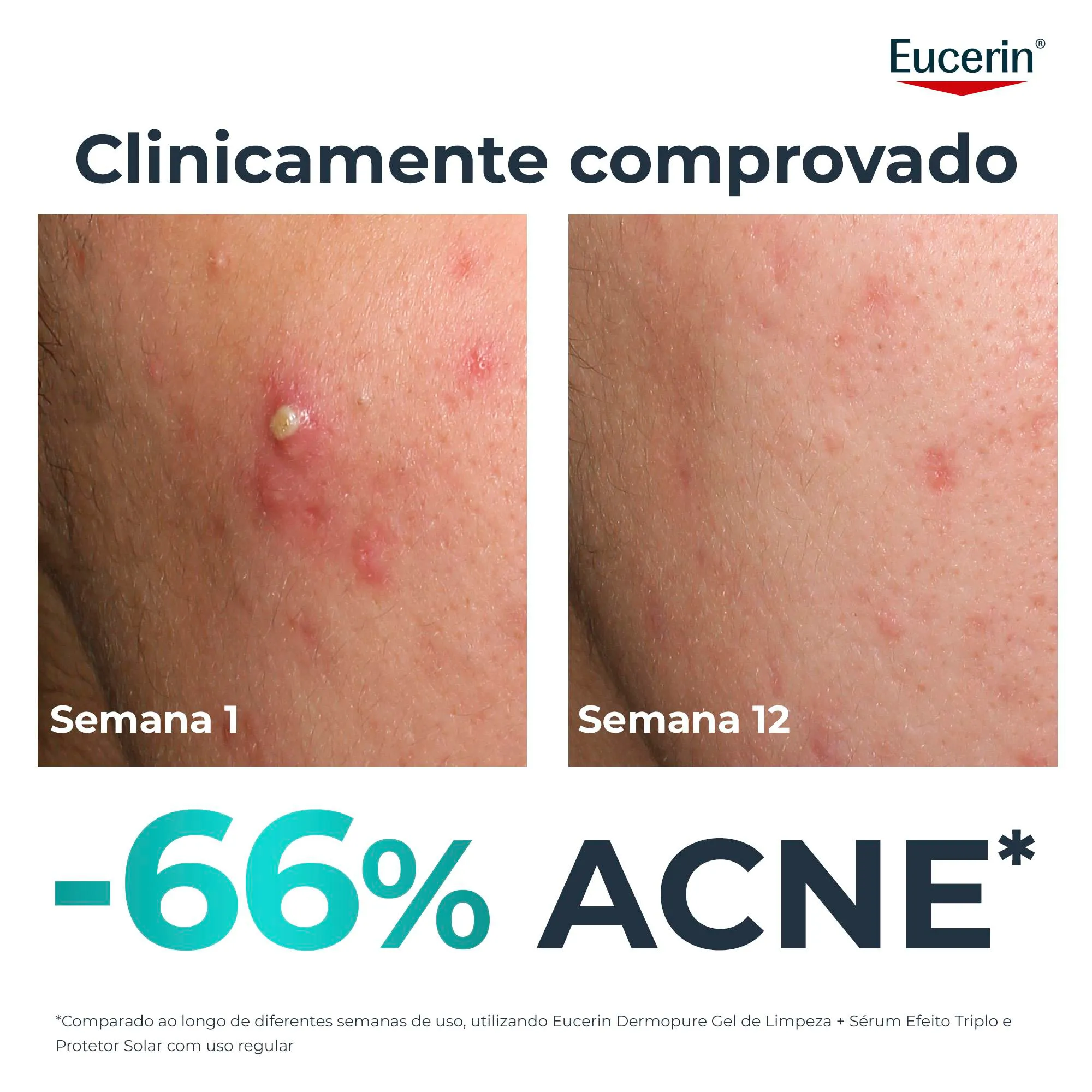 Eucerin DermoPure Oil Control Sérum Efeito Triplo 40ml