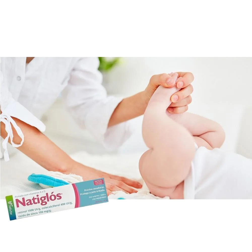 Natiglos Pomada Prevenção e Tratamento de Assaduras 45g Nativita