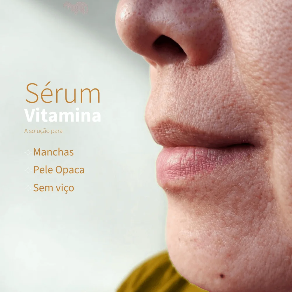 Kit 4 Sérum Vitamina C 15% Clareador Manchas