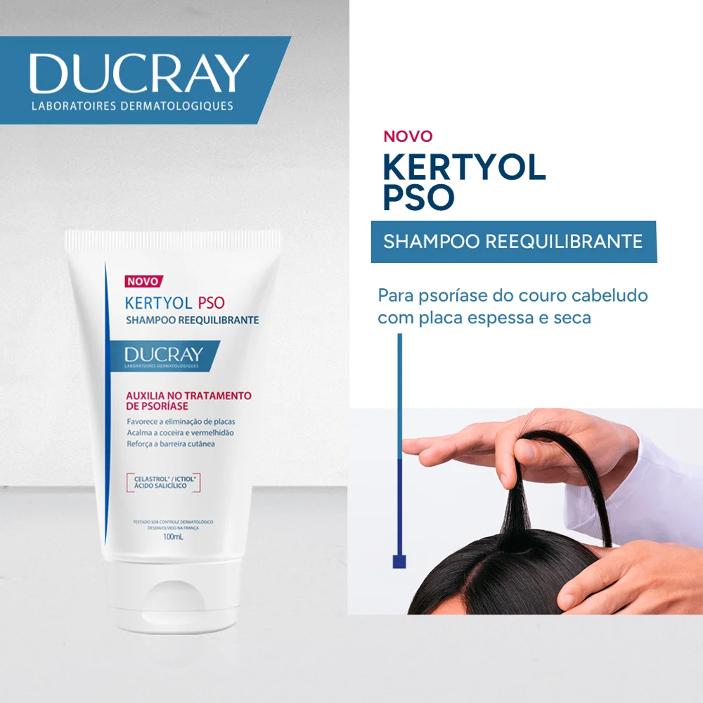 Shampoo Ducray Kertyol P.S.O Tratamento para Psoríase 100ml