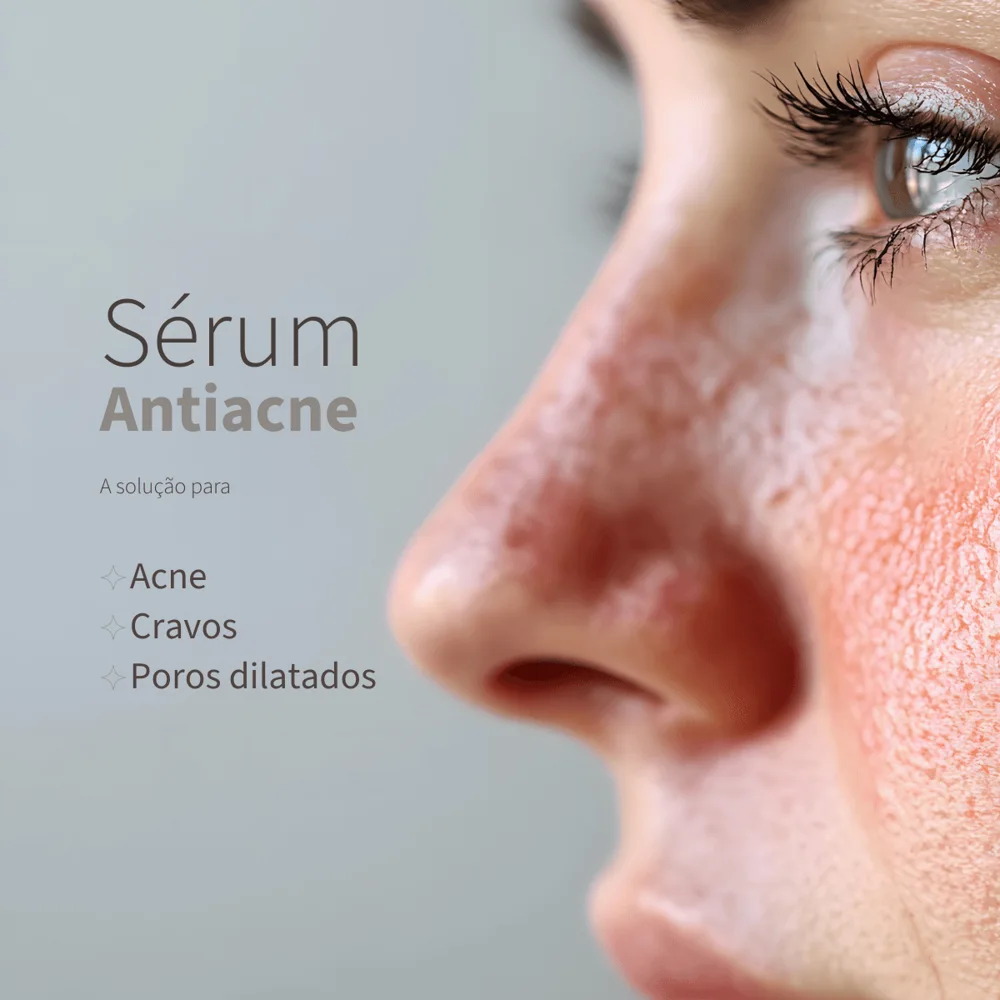 Kit 3  Sérum Antiacne Pele Oleosa
