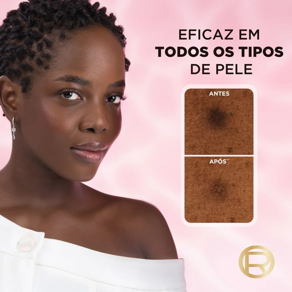 Sérum Facial L’Oréal Paris Glycolic Bright Antimarcas com Ácido Glicólico 7% e Niacinamida 30ml