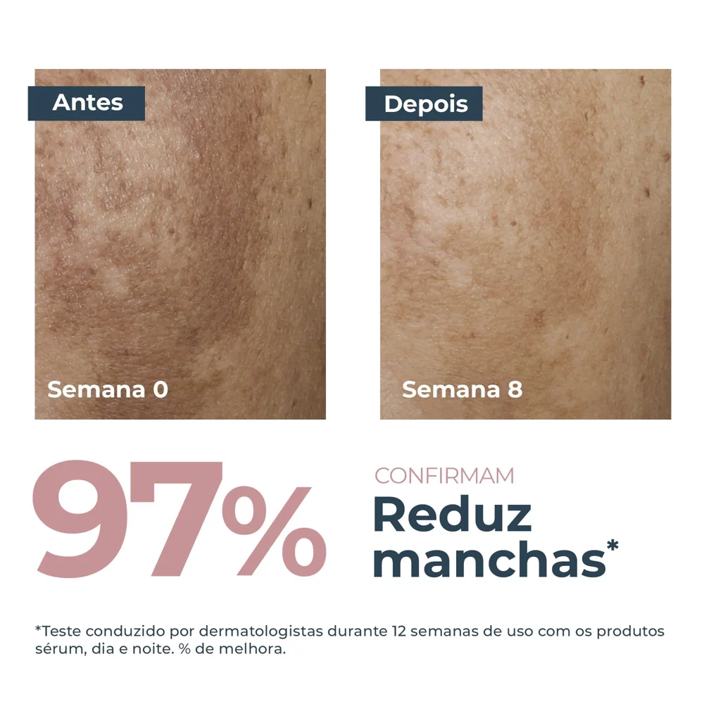 Sérum Facial Eucerin Anti-Pigment Clareador Dual 30ml