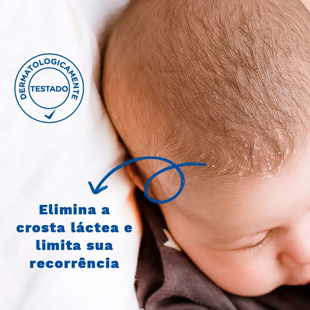 Creme para Crosta Láctea Mustela Stelaker Bebê Hipoalergênico 40ml