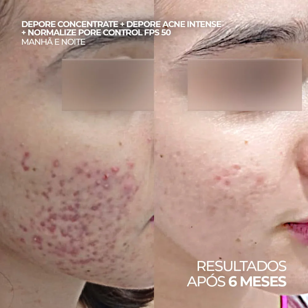 Gel de Limpeza Facial Ada Tina Depore Concentrate 250ml